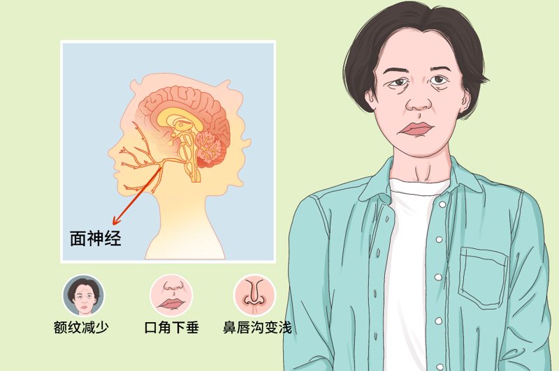 面对面神经问题，如何正确挂号？这一问题困扰着许多患者。今天我们就通过一个具体案例来解读这个问题。