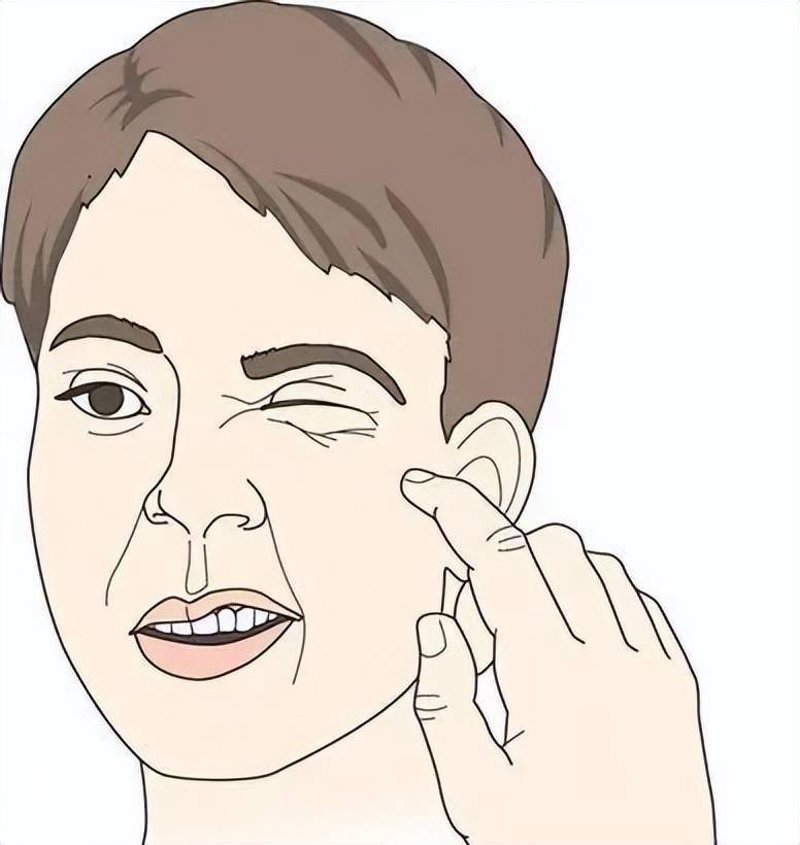 面神经麻痹：从常见误区到科学治疗